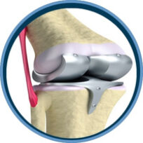 Ortopedista Julio César Ramírez